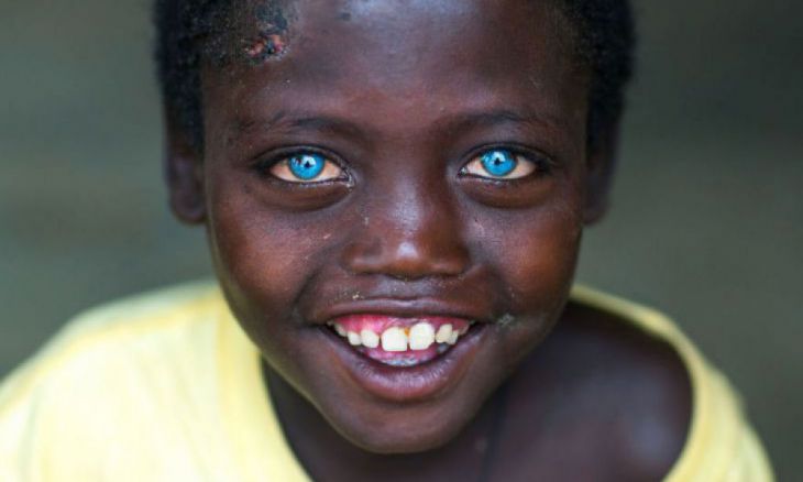 10 MAGNIFICENT EYES FROM AROUND THE WORLD